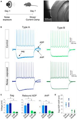 Loud noise-exposure changes the firing frequency of subtypes of layer 5 pyramidal neurons and Martinotti cells in the mouse auditory cortex